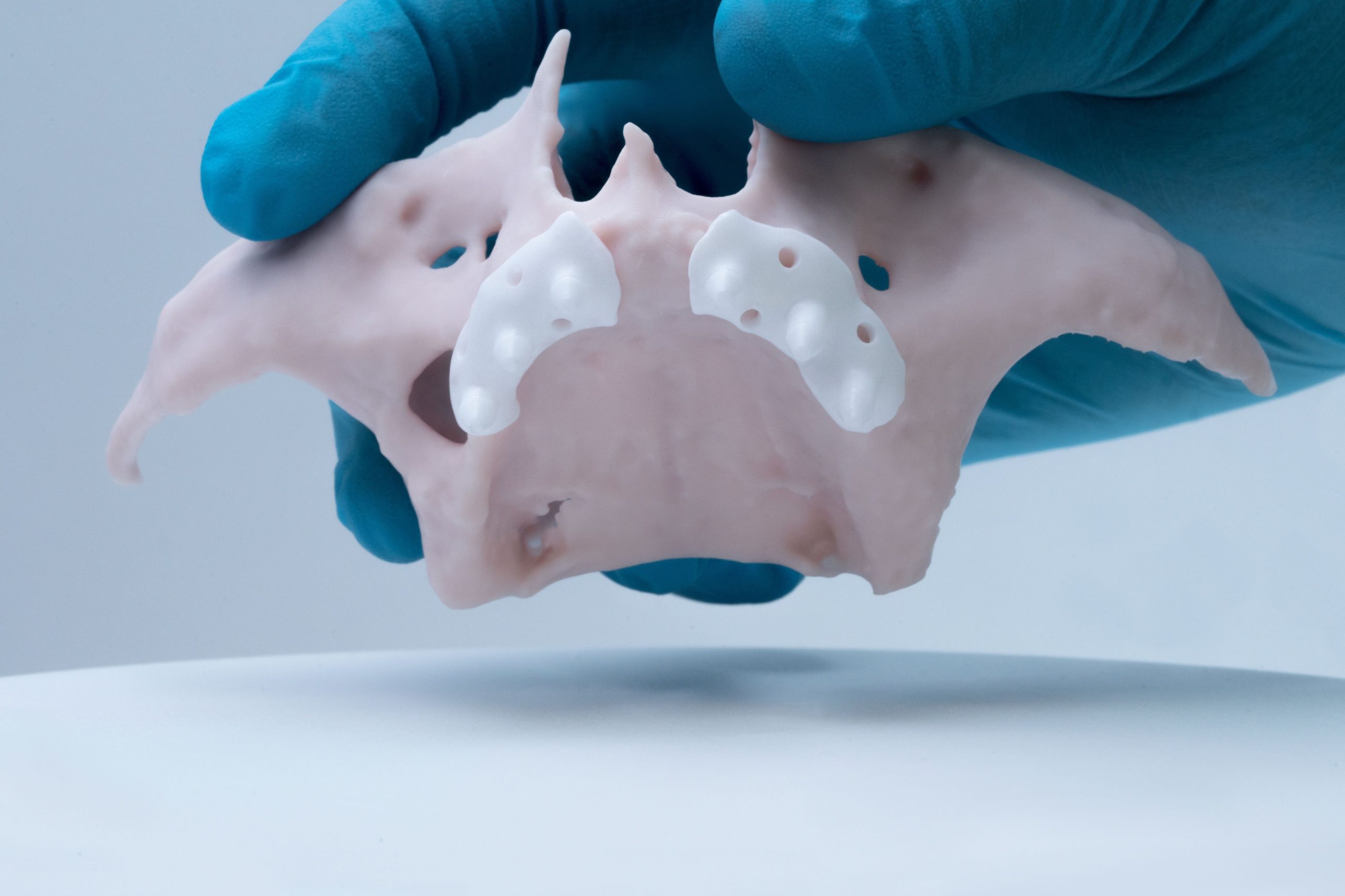 Ceramic subperiosteal jaw implant placed in patient for the first time ever
